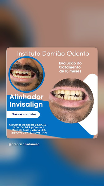 Foto 3 de Instituto Damião Odonto/Implantes/Harmonização Facial/Invisalign/Lentes de Contato- Vitória-ES