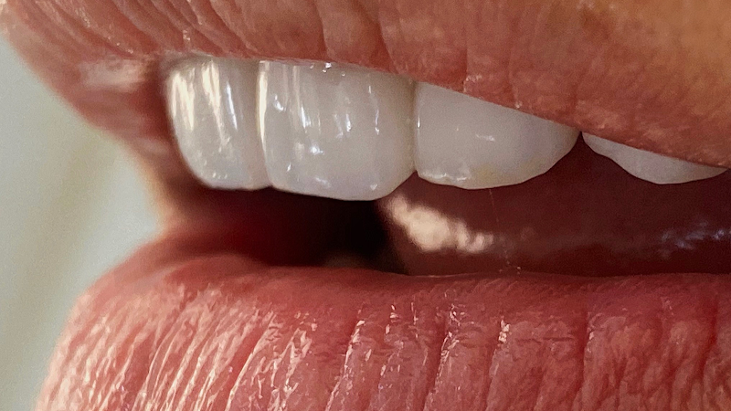Foto 2 de Instituto De Odontologia Estética