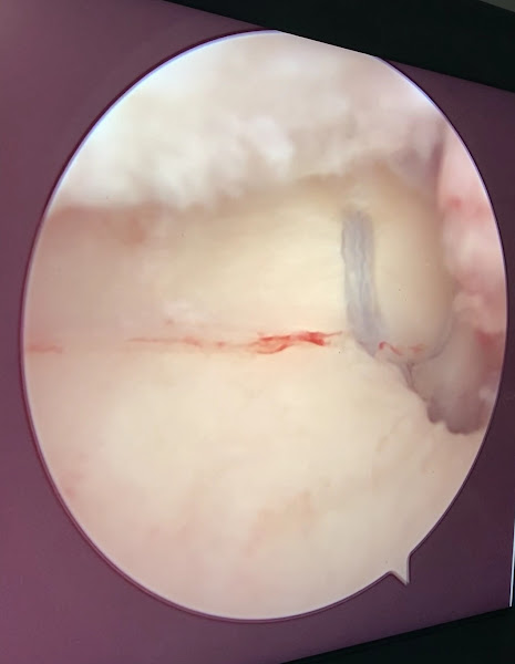 Foto 3 de Instituto do Joelho Cachoeiro De Itapemirim