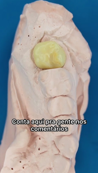 Foto 3 de Instituto Do Sorriso Clínica Odontológica referência em Implantes Dentários e Próteses Fixas