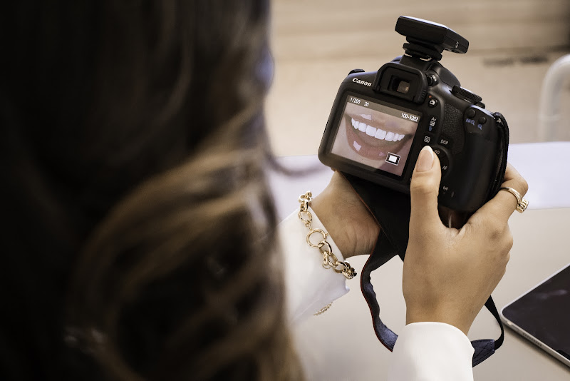 Foto 2 de Instituto Dra Bruna Santos - Lentes de resina e bem-estar do sorriso