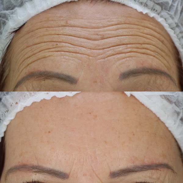 Foto 2 de Instituto Dra. Manu Cunha | Harmonização Orofacial