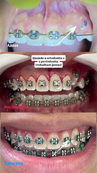 Foto 2 de Instituto Elem Lima