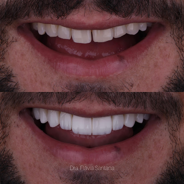 Foto 3 de Instituto Flávia Santana - Sorriso e Face