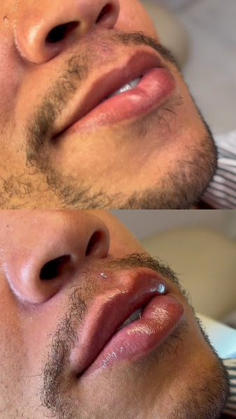 Foto 2 de Instituto Gleiciany Ferreira - Harmonização Facial Recreio dos Bandeirantes
