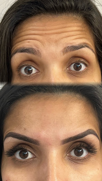 Foto 2 de Instituto Gleiciany Ferreira Harmonização Facial - Unidade Duque de Caxias