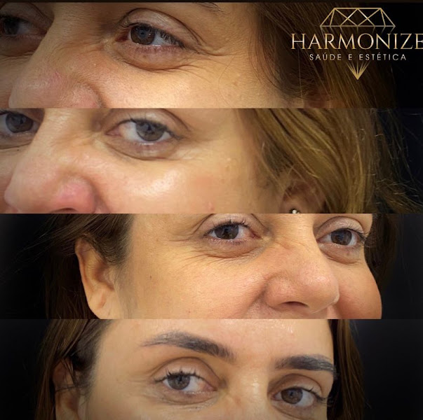 Foto 3 de Instituto Harmonyze odontologia e estética avançada
