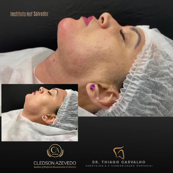 Foto 2 de Instituto HOF Salvador