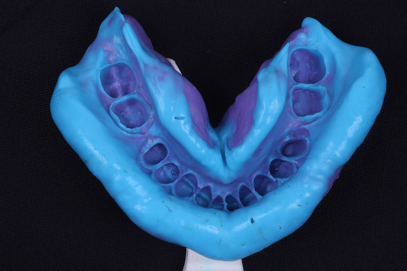 Foto 3 de Instituto Jarede - Odontologia e Saúde ( Implantes Dentários , Lentes de Contato e Psiquiatra)