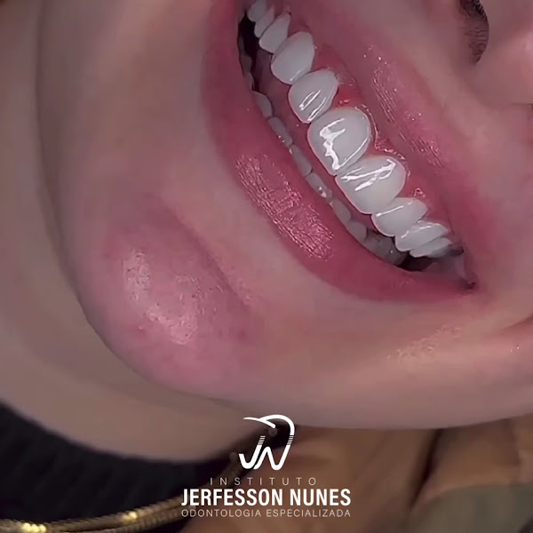 Foto 3 de Instituto Jerfesson Nunes | Odontologia Especializada