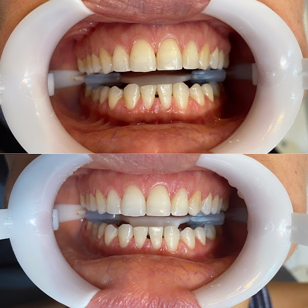 Foto 2 de Instituto Jivael Morais - Dentista Maceió - Urgência 24h