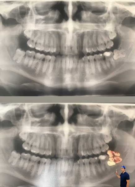 Foto 3 de Instituto Jivael Morais - Dentista Maceió - Urgência 24h