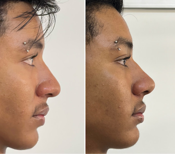 Foto 3 de Instituto Joyce Tomás