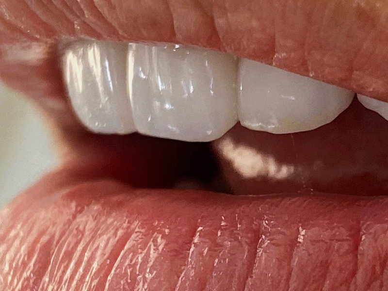 Foto 9 de Instituto Lima