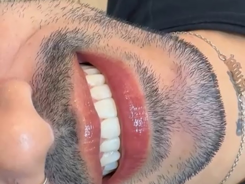 Foto 3 de INSTITUTO LP ODONTOLOGIA E ESTÉTICA HORTOLÂNDIA - Harmonização Facial, Implantes, Clareamento e Aparelhos Ortodonticos