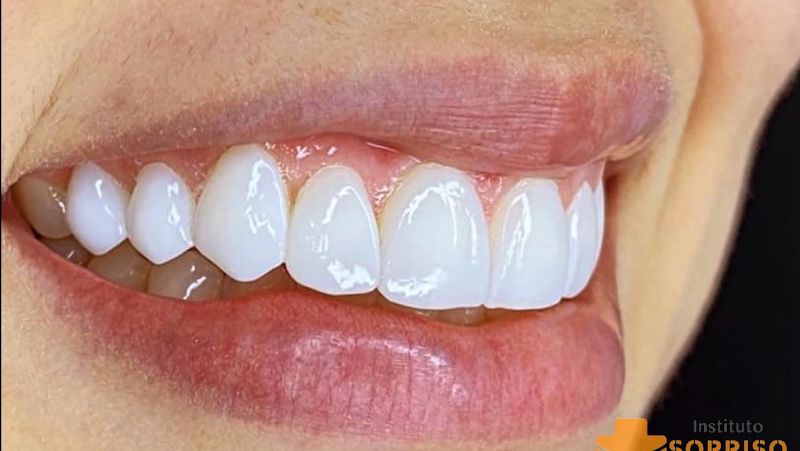 Foto 2 de INSTITUTO MAIS SORRISO - Odontologia