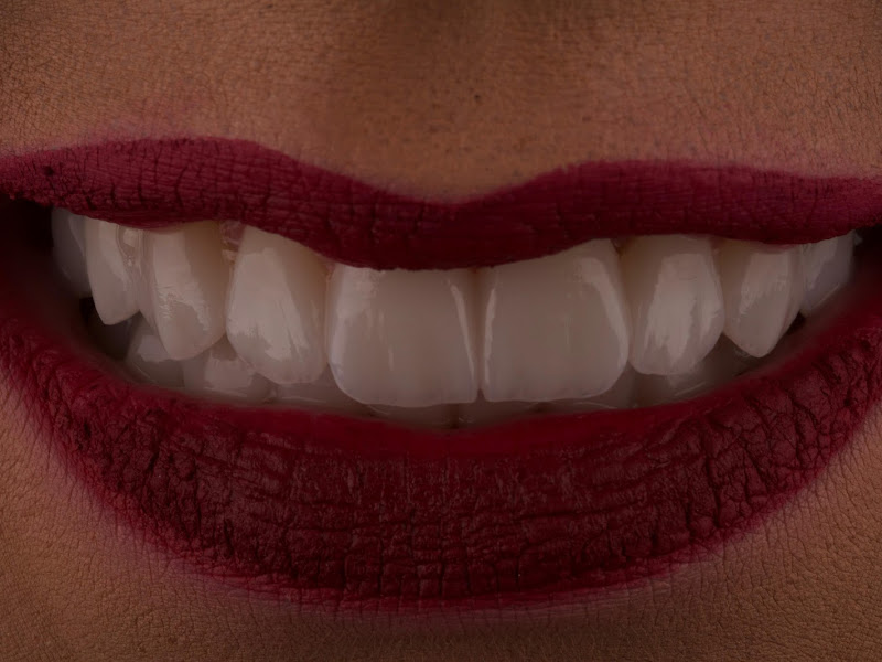 Foto 10 de Instituto Moema de Cirurgia Oral