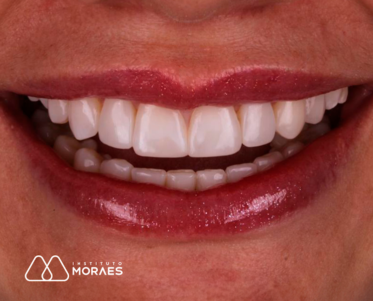 Foto 3 de Instituto Moraes Odontologia | Dentista | Implante | Prótese | Odontopediatria em Arapiraca