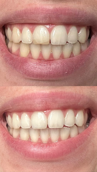 Foto 3 de Instituto Natália Marqui - Clínica Odontológica Campinas