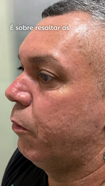 Foto 3 de Instituto Neves Evolução Facial - Clínica de Harmonização Facial e Orofacial Recreio