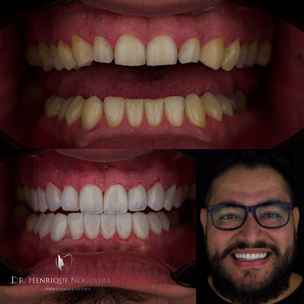 Foto 2 de Instituto Nogueira Odontologia e Estética