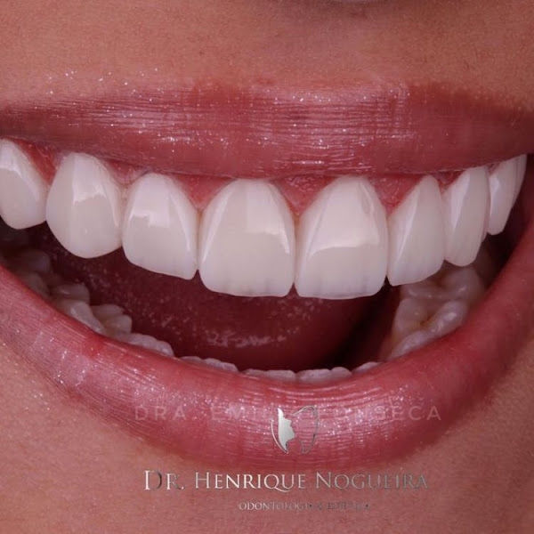 Foto 3 de Instituto Nogueira Odontologia e Estética