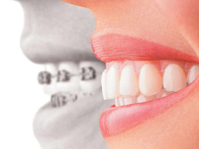 Foto 5 de Instituto Northo - Ortodontia e Terapias Integrativas