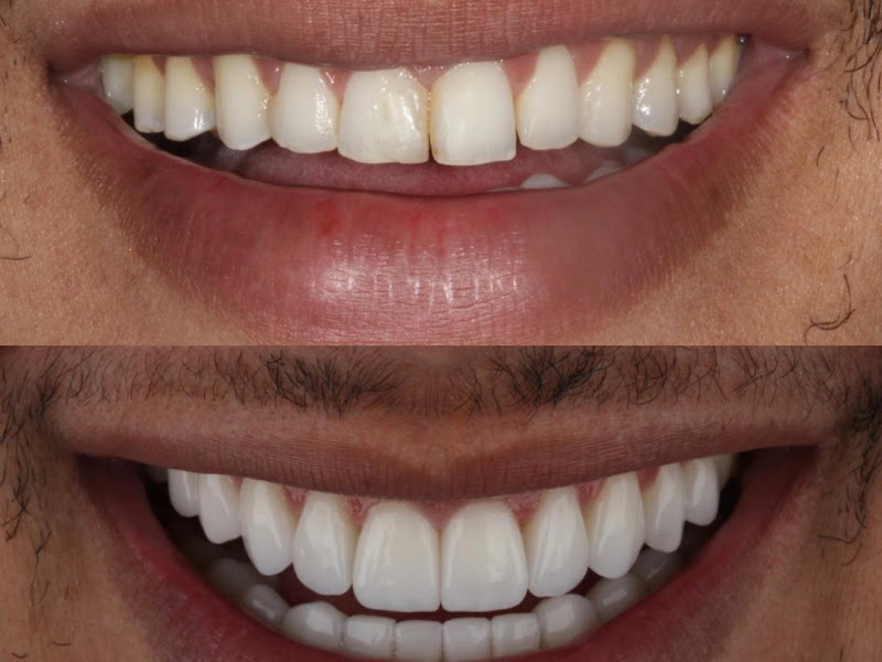 Foto 7 de Instituto Odontológico Drs. Flavio e Silvana Menezes