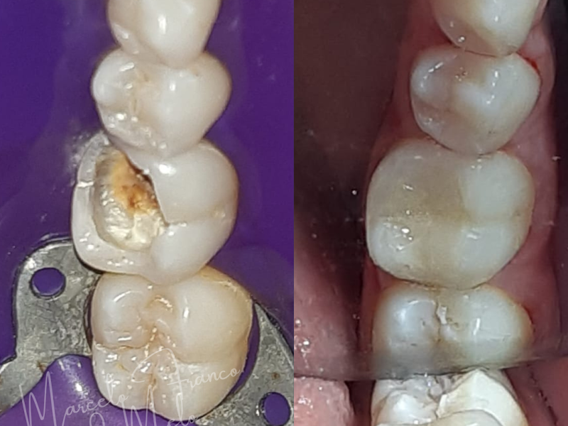 Foto 3 de Instituto Odontológico Marcelo Franco de Melo