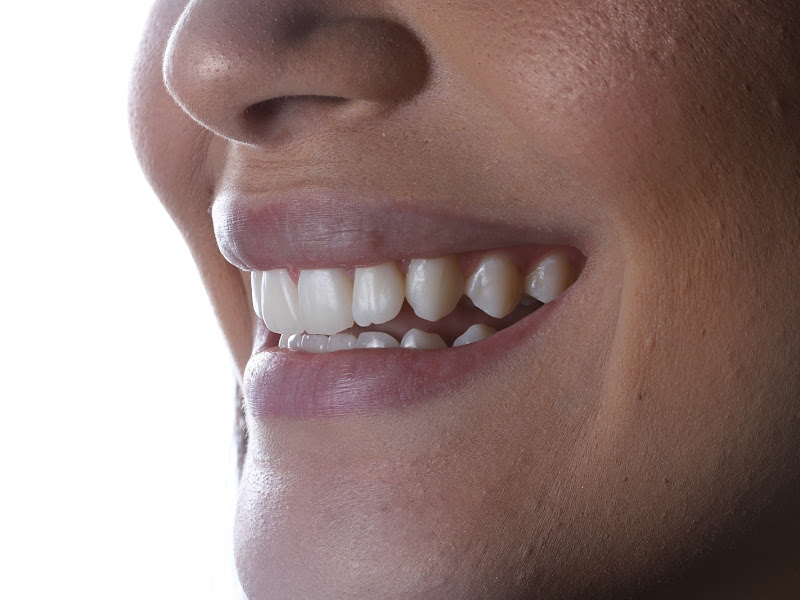 Foto 3 de Instituto Odontológico Marinho Wanderley