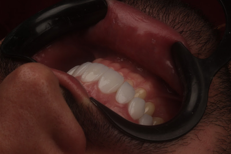 Foto 2 de Instituto Odontológico Millen