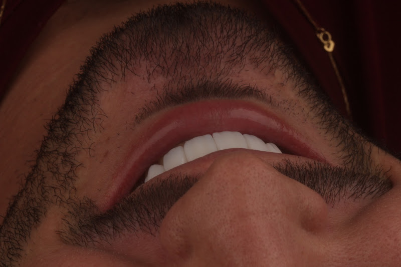 Foto 3 de Instituto Odontológico Millen