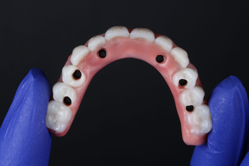 Foto 3 de Instituto Renova de Implantodontia avançada e Odontologia digital