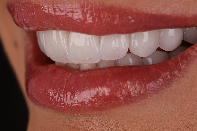 Foto 3 de INSTITUTO ROESSLER