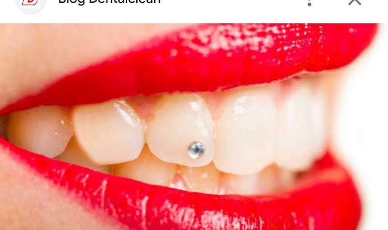 Foto 3 de Instituto S&S Odontologia e Estética - Clínica odontológica em Interlagos, Vila Natal e Primavera Interlagos.