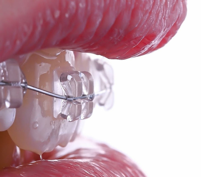 Foto 3 de Instituto Sorriso