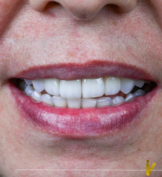 Foto 2 de Instituto Vale Odontologia