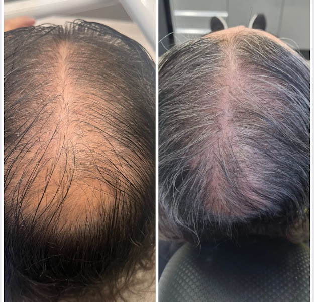 Foto 3 de Instituto Valeska Guerra - Harmonização Facial e Corporal