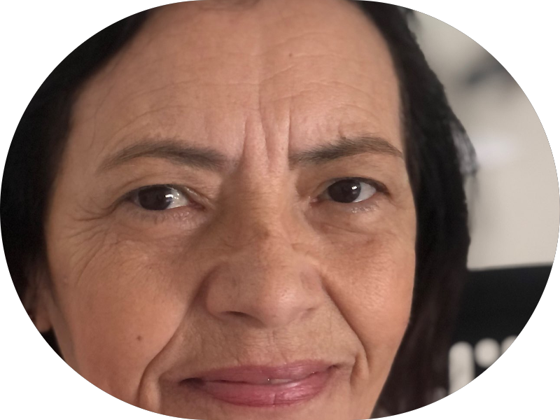 Foto 2 de Instituto Velasco - Cursos em Harmonização Facial e Implantodontia