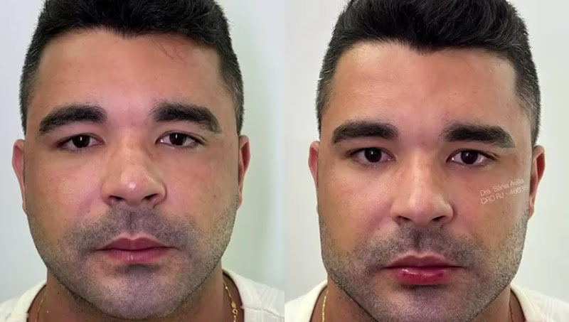 Foto 3 de Instituto Vitallis | Estética Facial | Dentista | Implante Dentário | Barra da Tijuca