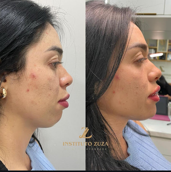 Foto 3 de Instituto Zuza - Harmonização facial e corporal - Campo Grande