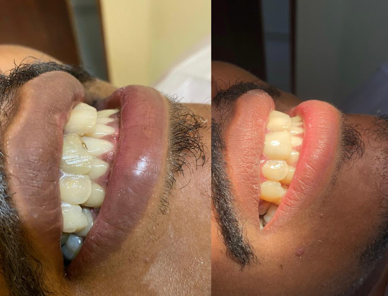 Foto 3 de Integralle Odonto