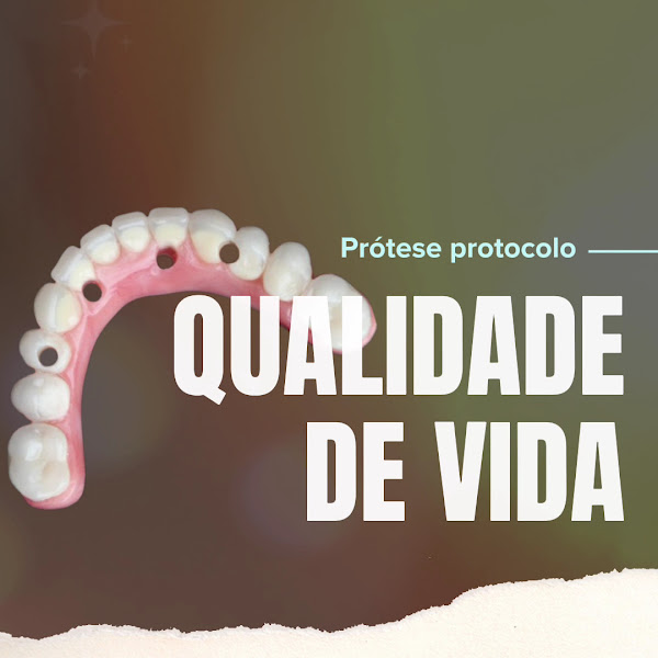 Foto 4 de Intensa Odontologia - Clinica Especializada em Implantes Dentários, Prótese Protocolo e Prótese Fixa em Petrópolis - RJ
