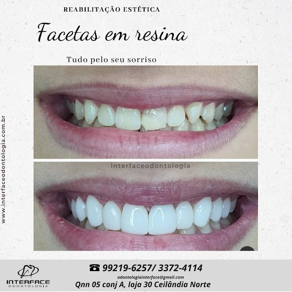 Foto 4 de INTERFACE ODONTOLOGIA