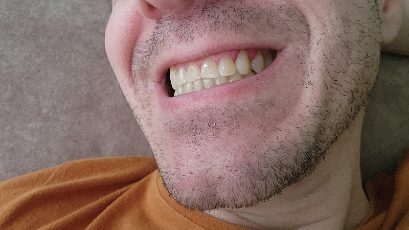 Foto 2 de Interodonto-Sistema de Saúde Odontológica