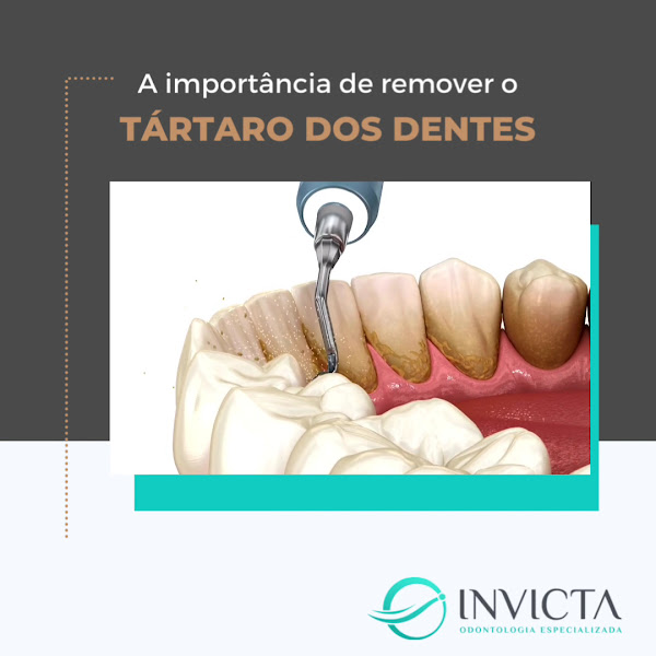 Foto 3 de INVICTA ODONTOLOGIA ESPECIALIZADA