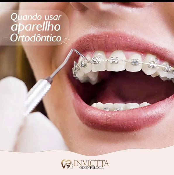 Foto 3 de Invictta Odontologia