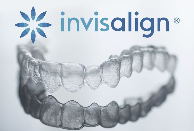 Foto 2 de Invisalign - Dr Gustavo Salem