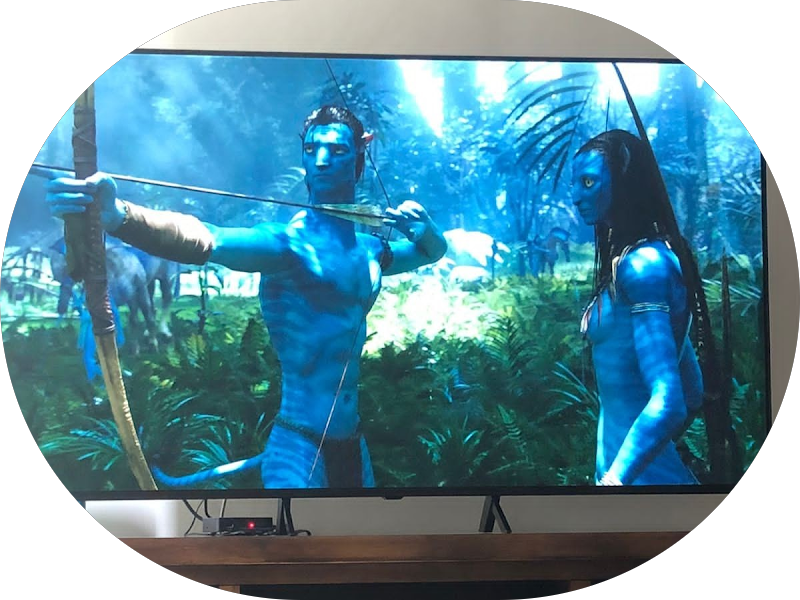 Foto 4 de Invisalign e Harmonização Facial Feira de Santana - Portugal Odontologia por Dra Camila Gomes