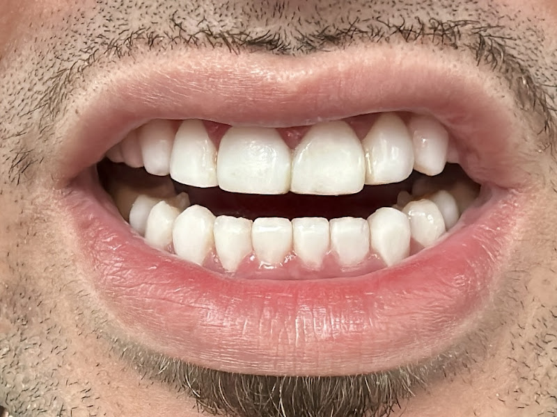 Foto 5 de Invisalign em Santos - GS Odontologia e Saúde